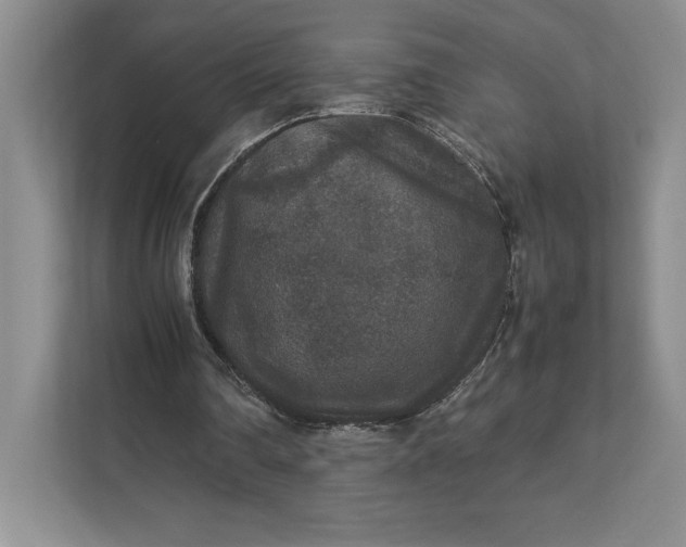 X0000111810290200908061121
