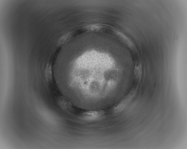 X0000111810381200908061120