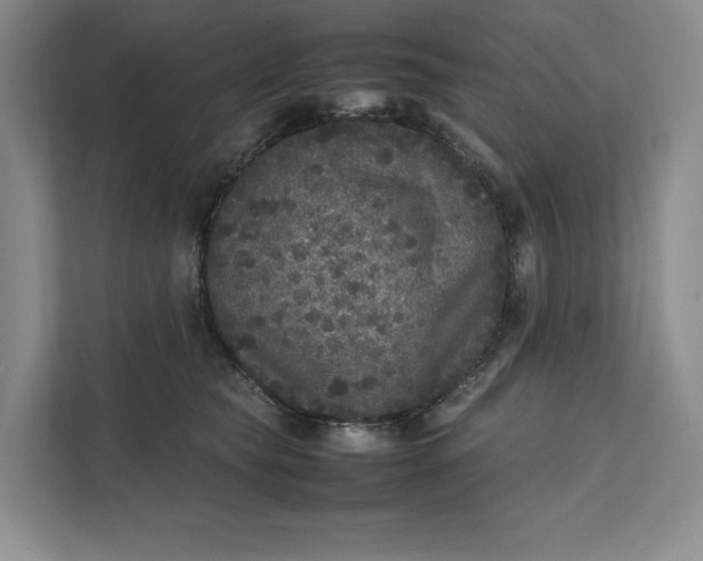 X0000111810565200908061117