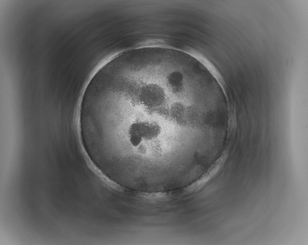 X0000111810957200908061113