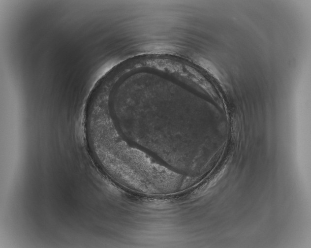 X0000111811071200908061111