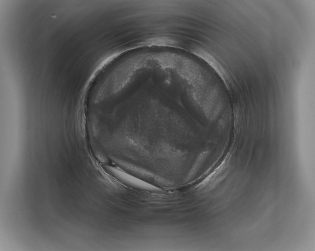 X0000111811115200908061110