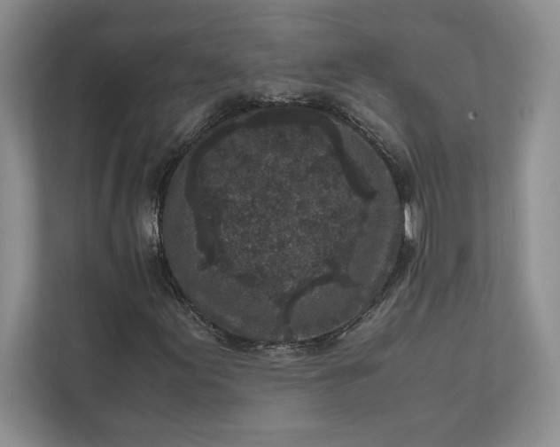 X0000111811155200908061109