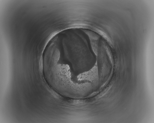 X0000111811275200908061108
