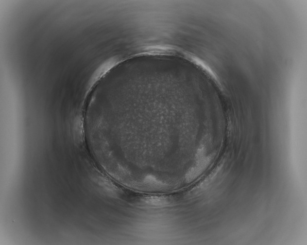 X0000111811362200908061107