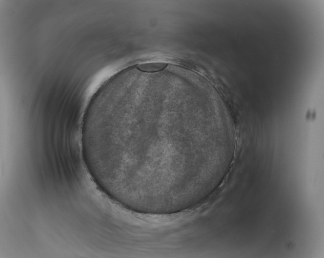 X0000111810006200908131510