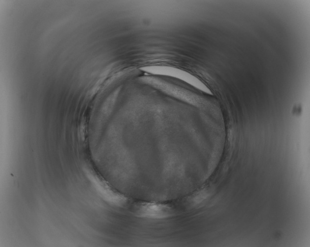 X0000111810379200908131505