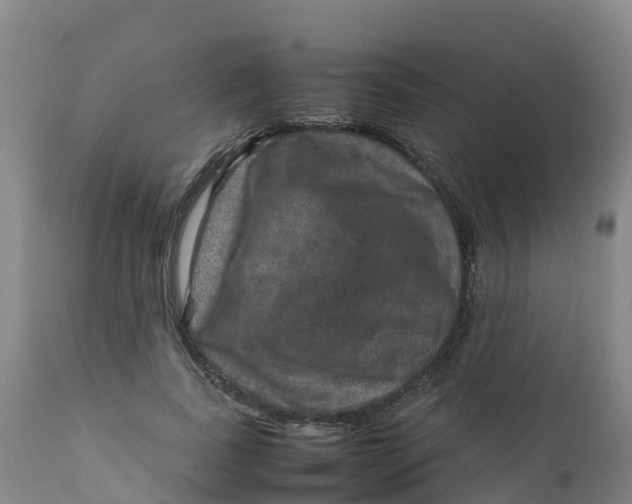 X0000111810739200908131459