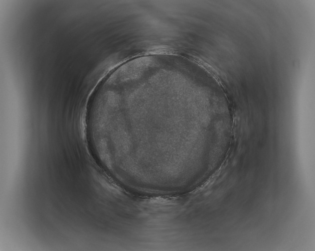 X0000111810290200908201116