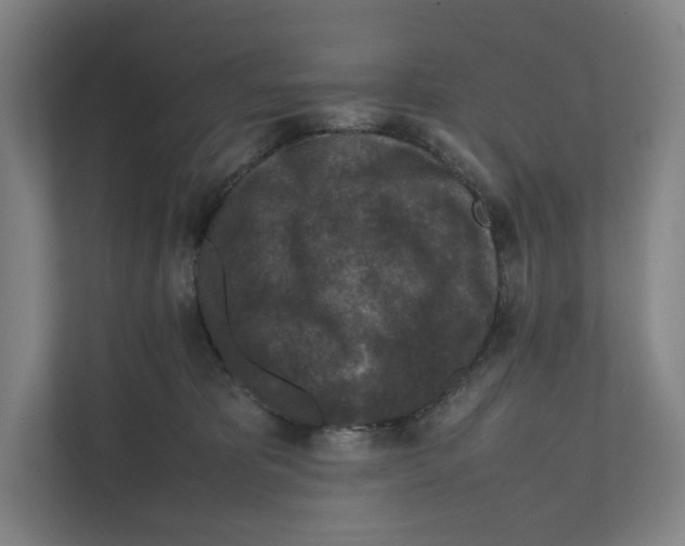 X0000111810325200908201115
