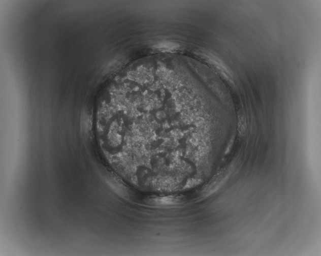 X0000111810365200908201115