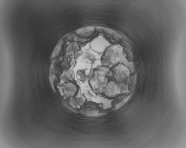 X0000111810377200908201115