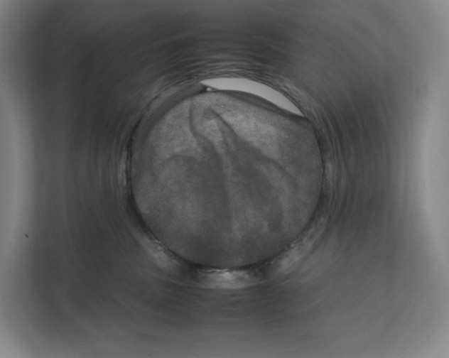 X0000111810379200908201115