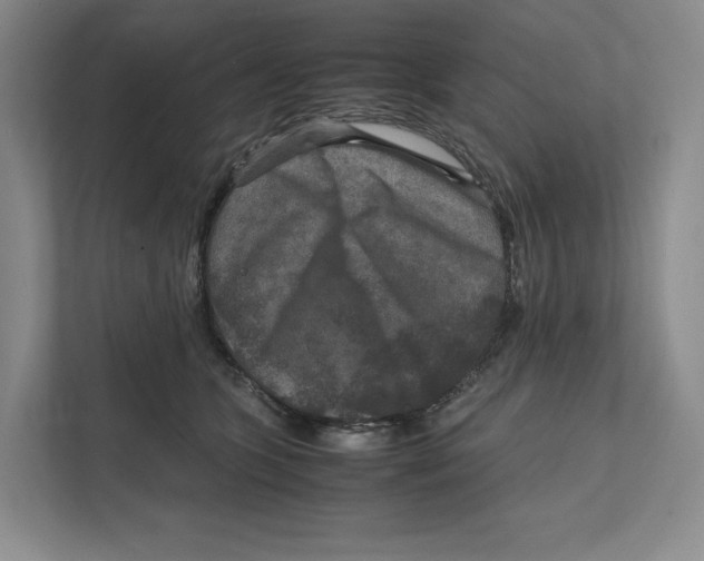 X0000111810563200908201113