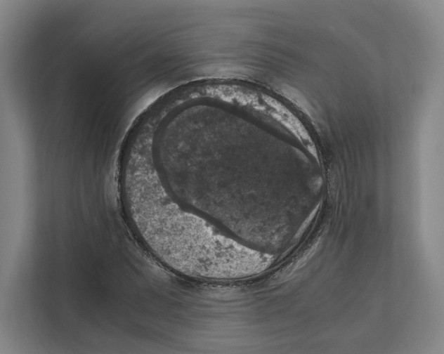 X0000111811071200908201106