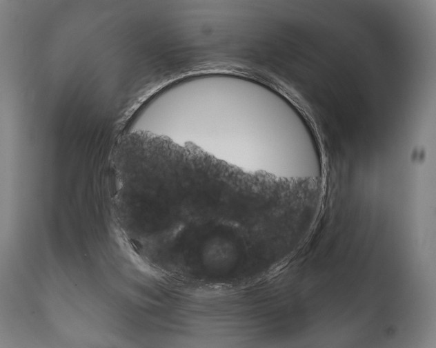 X0000111820155200907231033