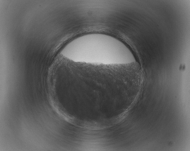X0000111820163200907231033