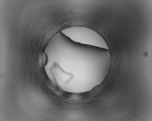 X0000111820335200907231030