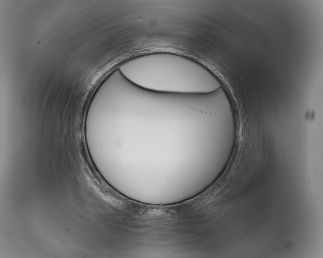 X0000111820390200907231030