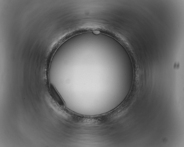 X0000111820399200907231030