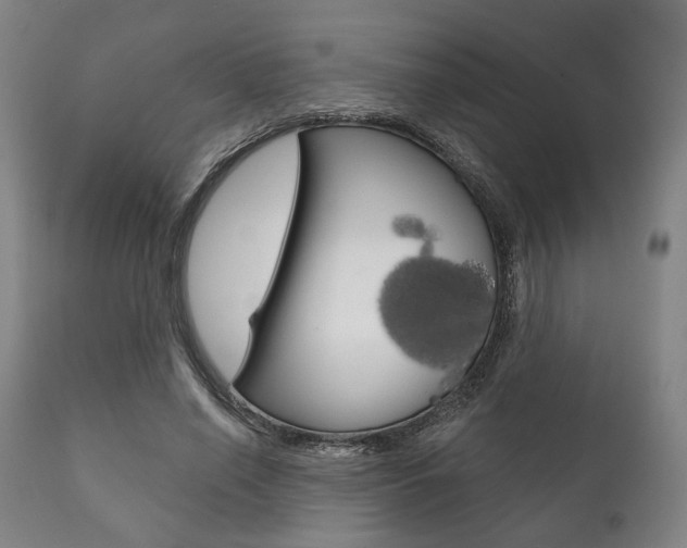 X0000111820638200907231025