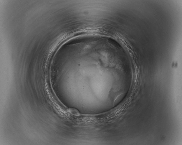 X0000111820145200907231326