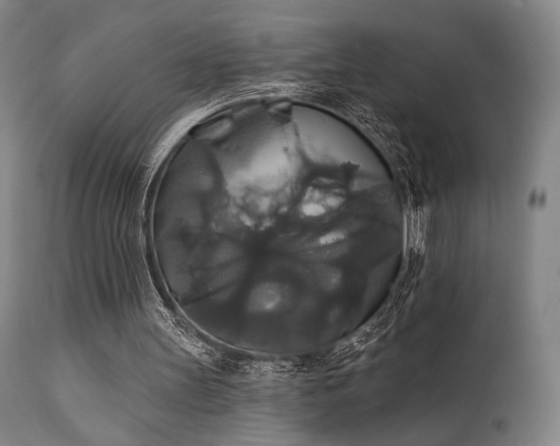 X0000111820147200907231326