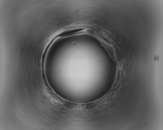 X0000111820148200907231326