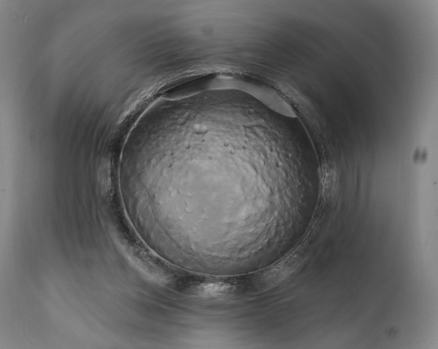 X0000111820158200907231326