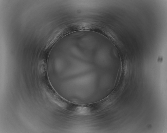 X0000111820169200907231326