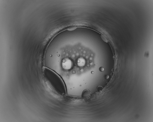 X0000111820155200907301305