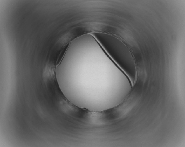 X0000111820141200908061143