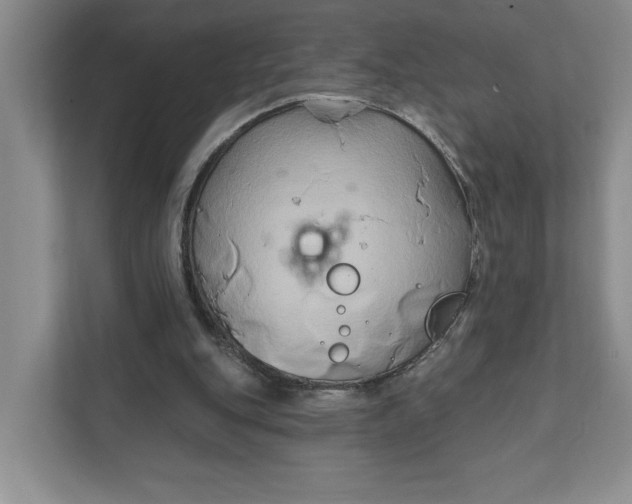 X0000111820151200908061142