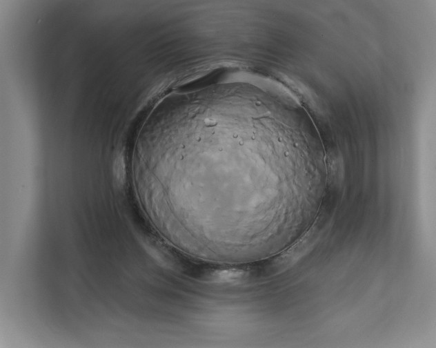 X0000111820158200908061142