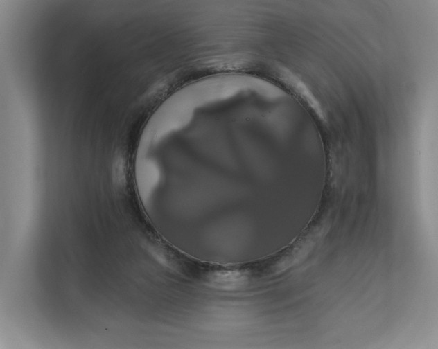 X0000111820161200908061142