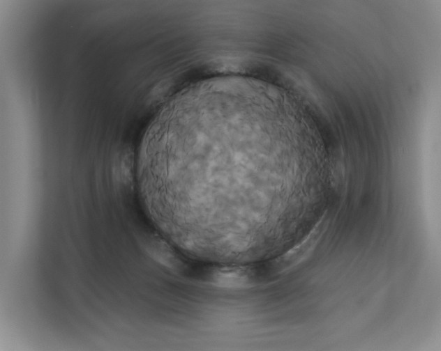 X0000111820175200908061142