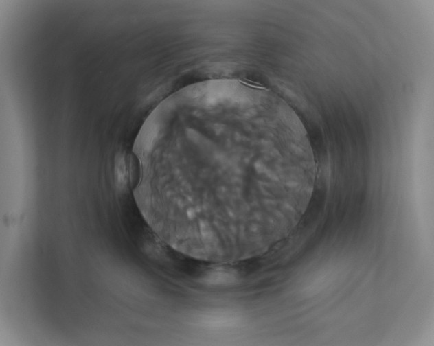 X0000111820335200908061140