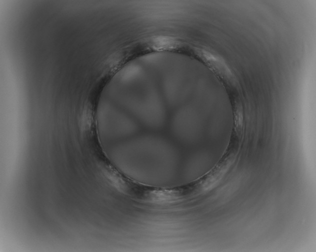 X0000111820367200908061140