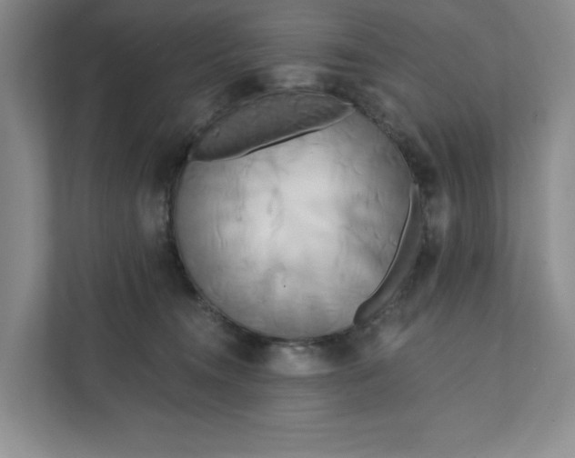 X0000111820372200908061140