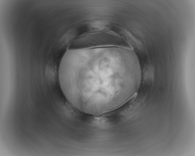 X0000111820376200908061140