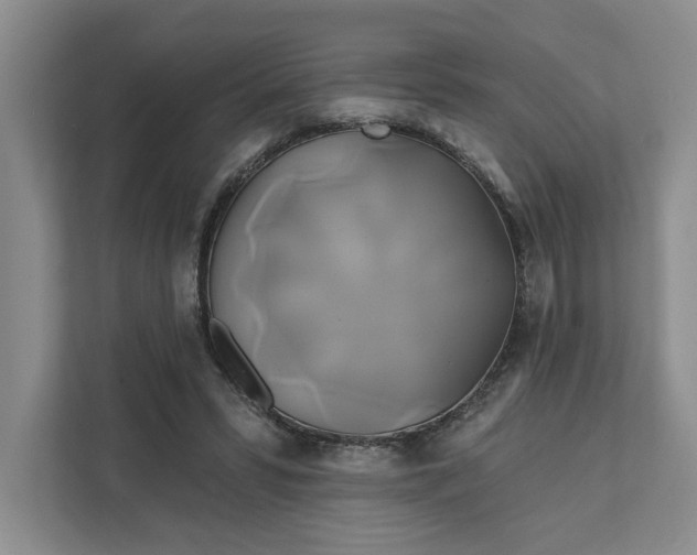 X0000111820399200908061139