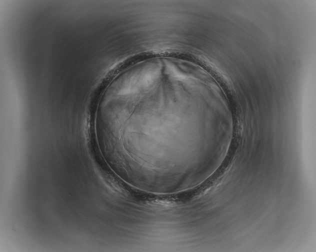 X0000111820592200908061137