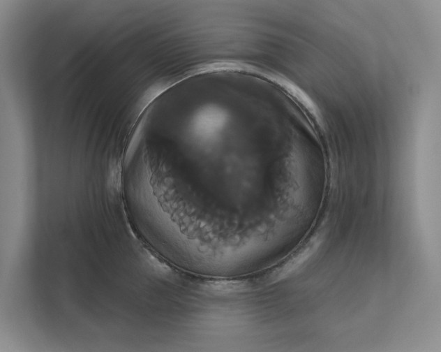 X0000111820953200908061133