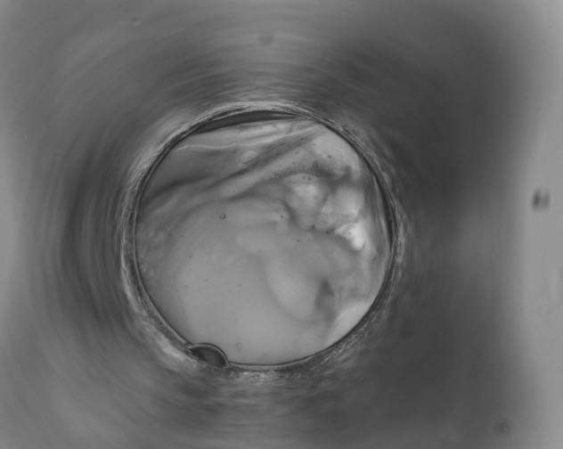 X0000111820145200908131530