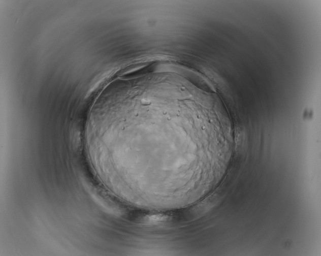 X0000111820158200908131531