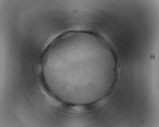 X0000111820164200908131531