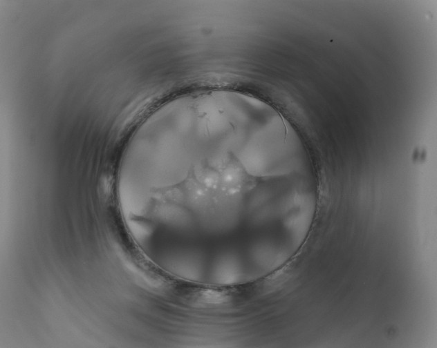 X0000111820166200908131531