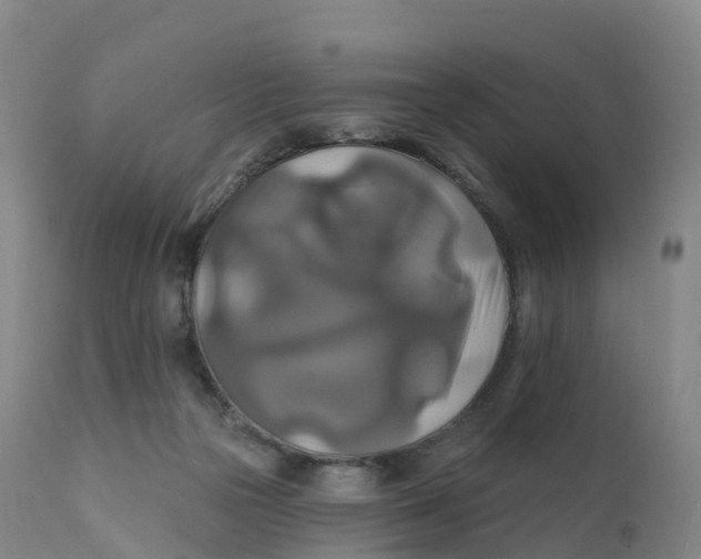 X0000111820169200908131531