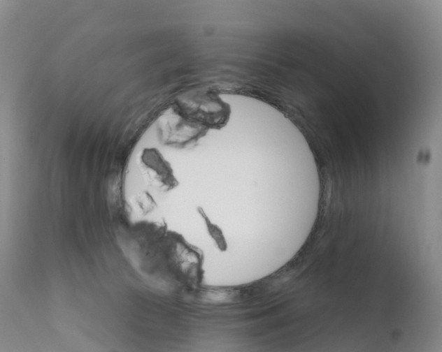 X0000111820177200908131531