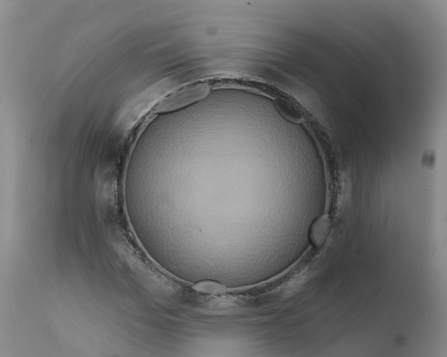 X0000111820969200908131519